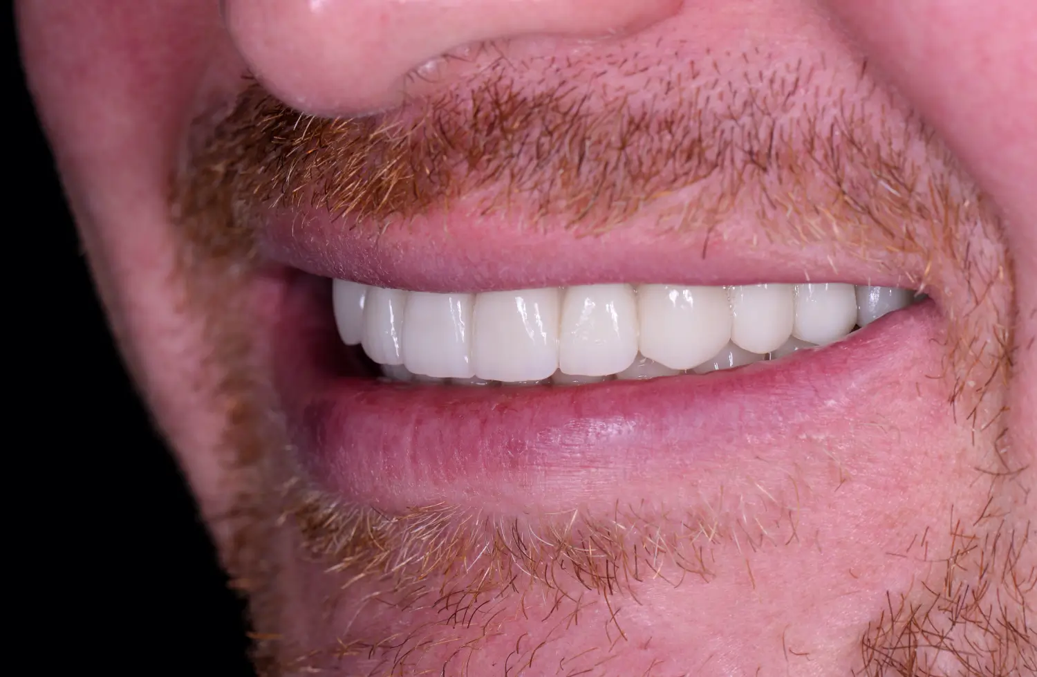 After treatment outcome