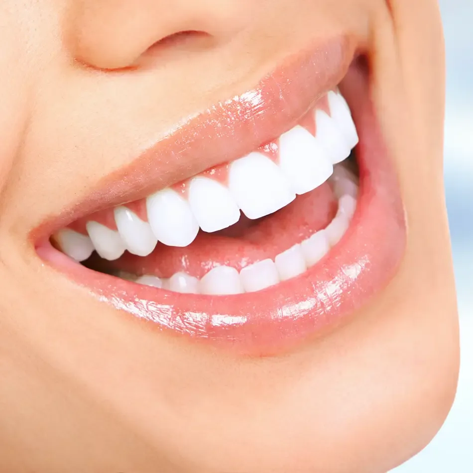 Zirconium Crowns