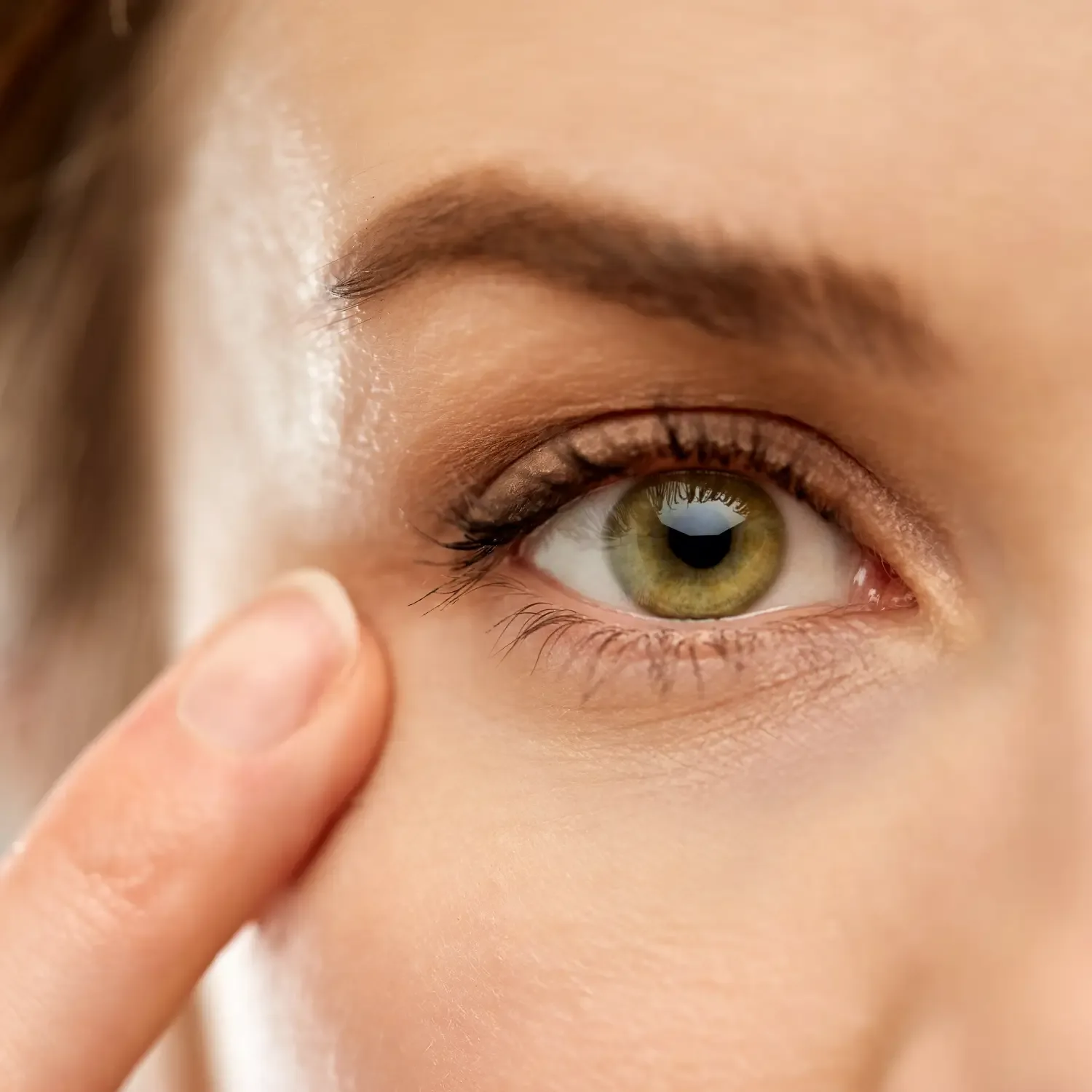 Eyelid Surgery treatment image