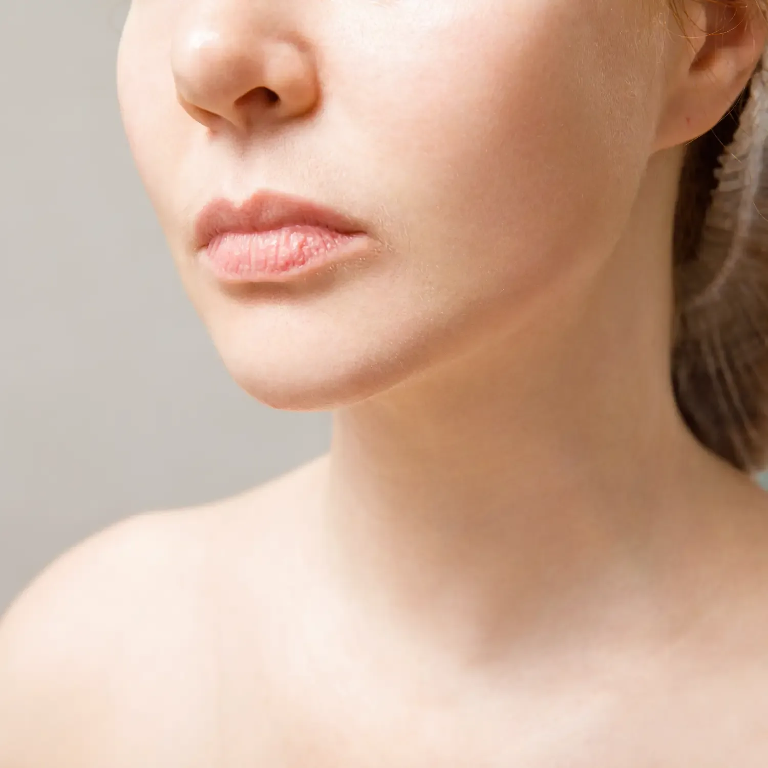 Neck Lift before treatment comparison image