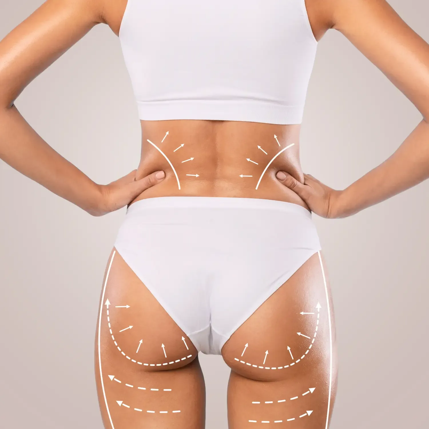 Laser Assisted - Liposuction treatment image