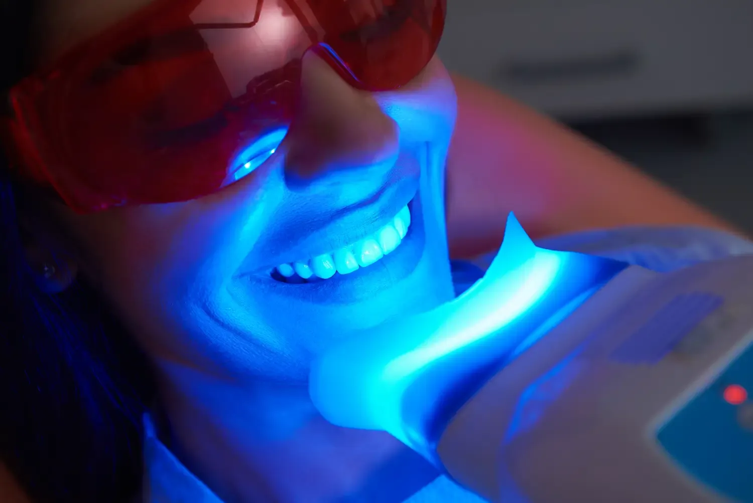 Teeth Whitening treatment image