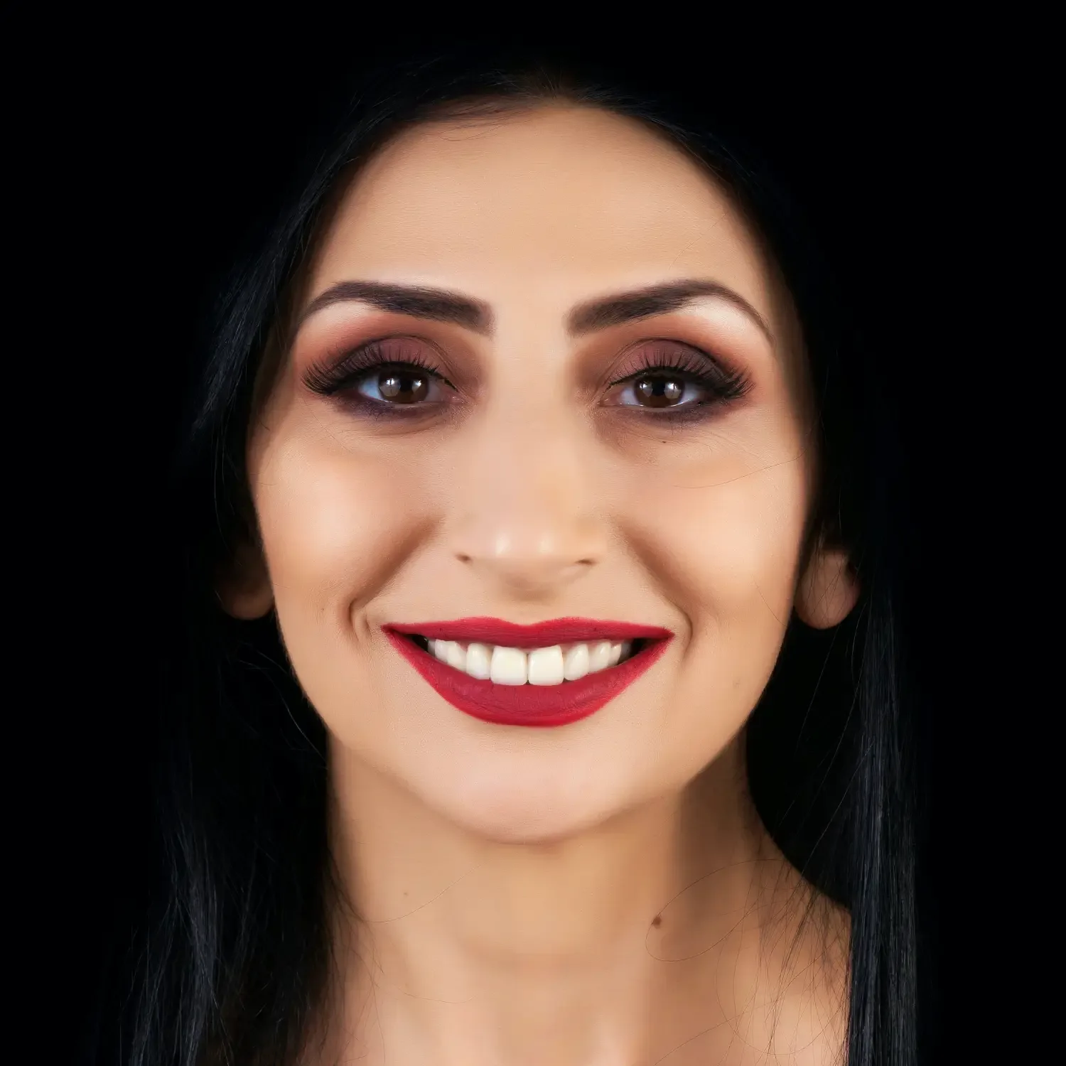 Veneers before treatment comparison image