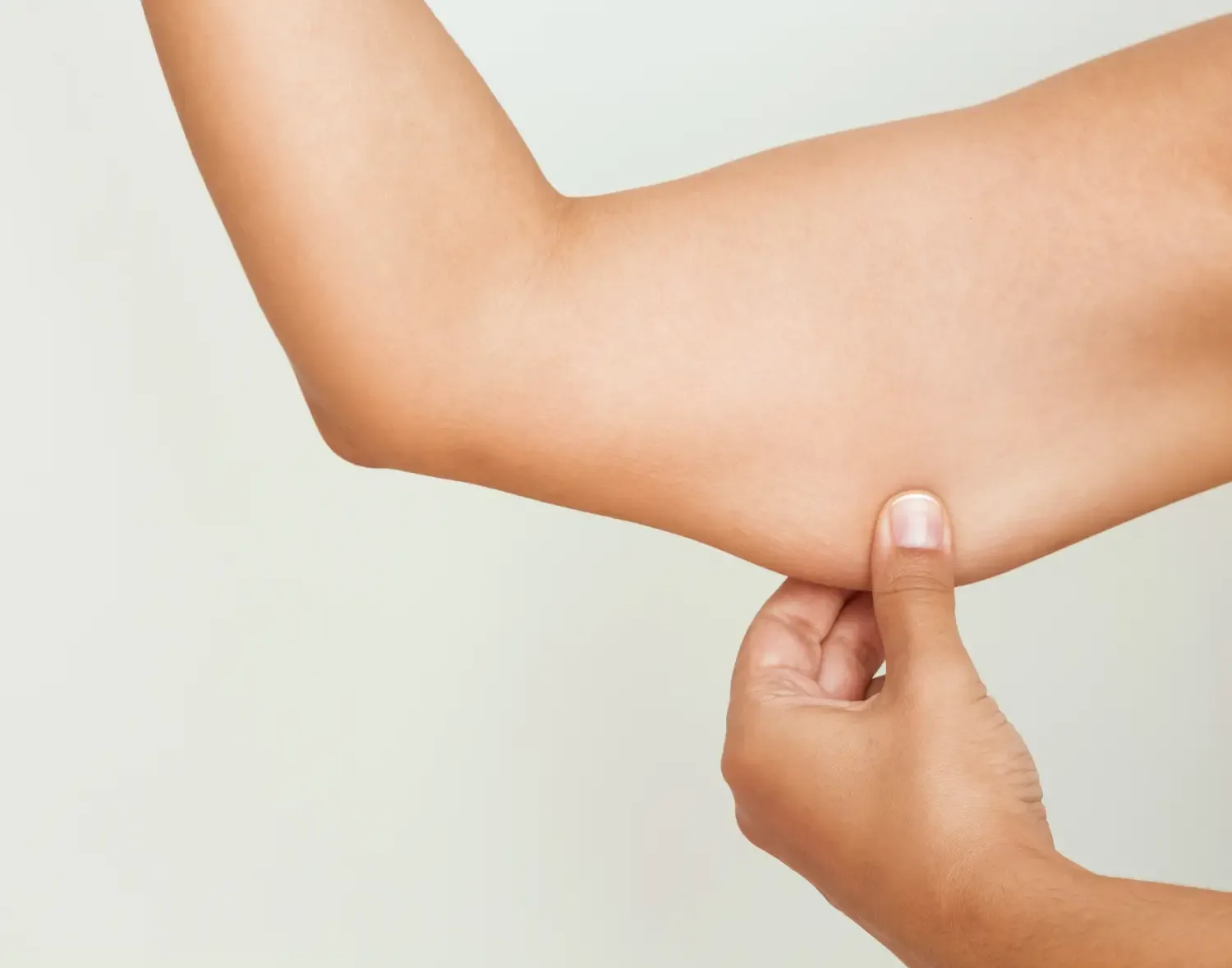 Arm Lift treatment image