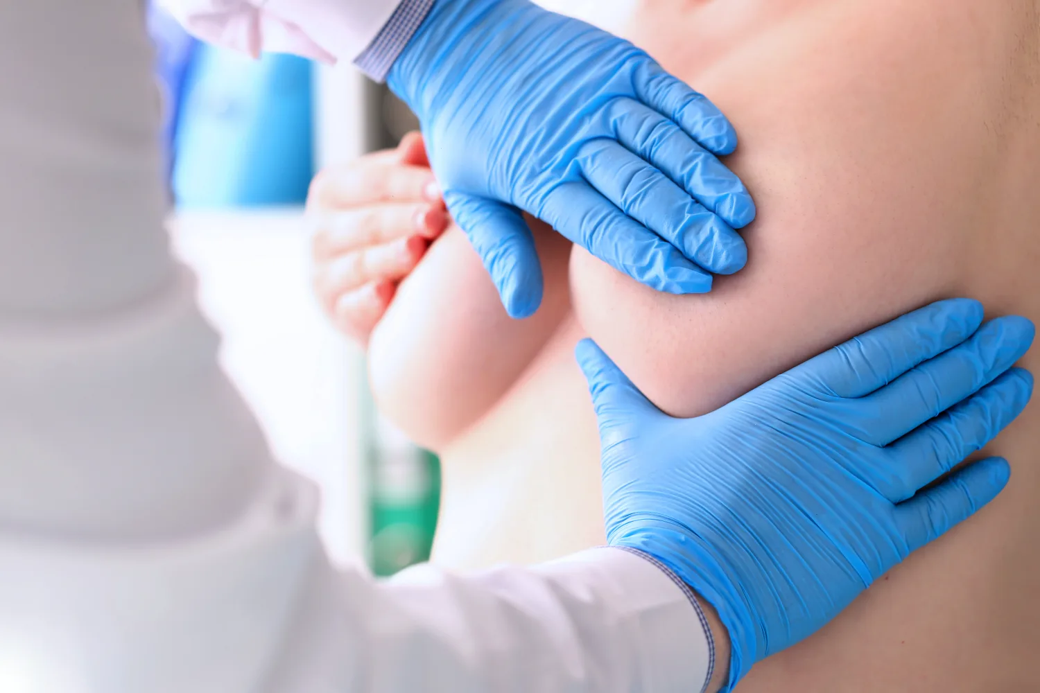 Breast Lift treatment image